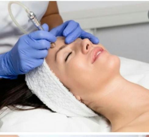 MICRODERMOABRASION FACIAL