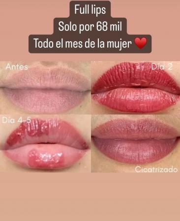 MICRO PIGMENTACIÓN,  FULL LIPS Y MICRO BLADING