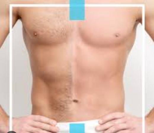 DEPILACION MASCULINA