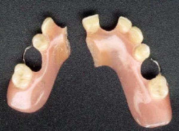 REPARO PRÓTESIS DENTAL